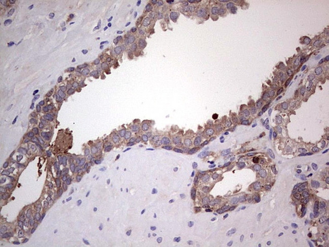 PKM2 Antibody in Immunohistochemistry (Paraffin) (IHC (P))