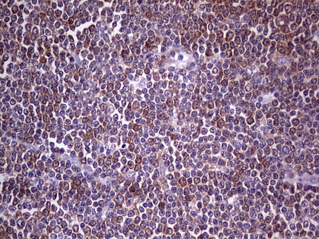 PKM2 Antibody in Immunohistochemistry (Paraffin) (IHC (P))