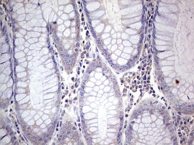 PKM2 Antibody in Immunohistochemistry (Paraffin) (IHC (P))