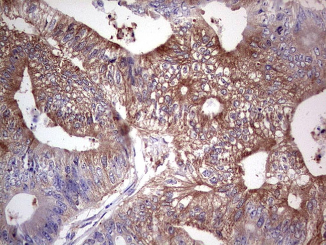 PKM2 Antibody in Immunohistochemistry (Paraffin) (IHC (P))