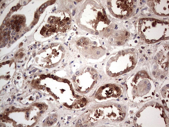 PKM2 Antibody in Immunohistochemistry (Paraffin) (IHC (P))