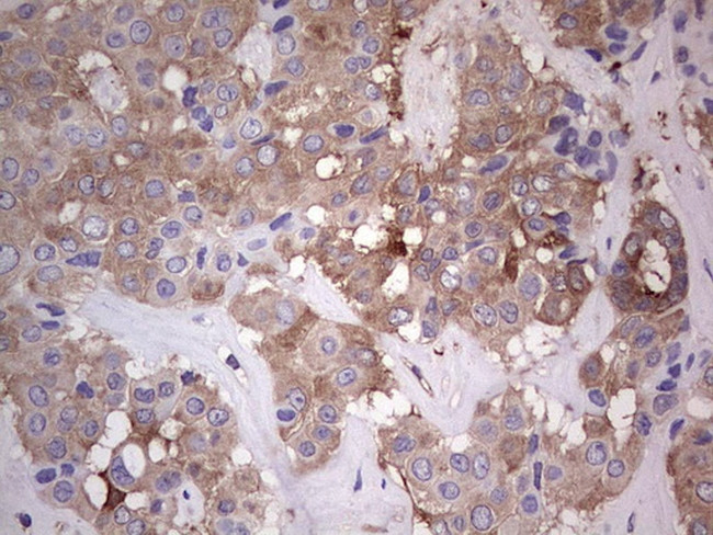 PKM2 Antibody in Immunohistochemistry (Paraffin) (IHC (P))