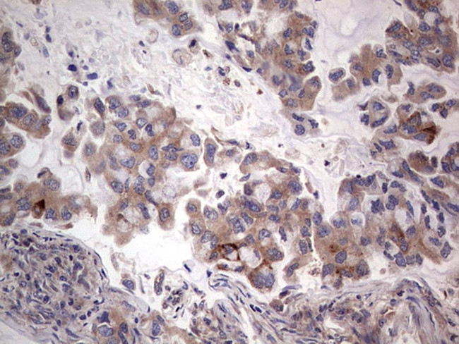 PKM2 Antibody in Immunohistochemistry (Paraffin) (IHC (P))