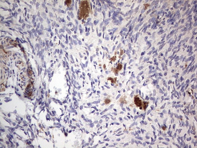 PKM2 Antibody in Immunohistochemistry (Paraffin) (IHC (P))