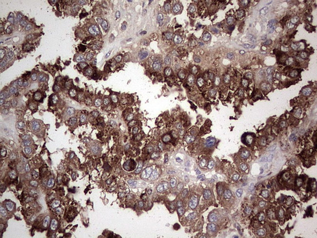 PKM2 Antibody in Immunohistochemistry (Paraffin) (IHC (P))