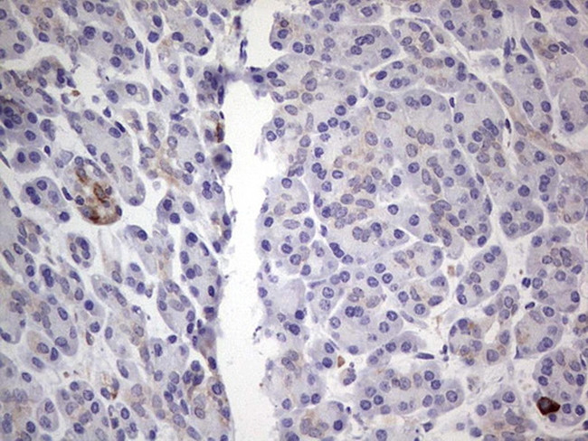 PKM2 Antibody in Immunohistochemistry (Paraffin) (IHC (P))