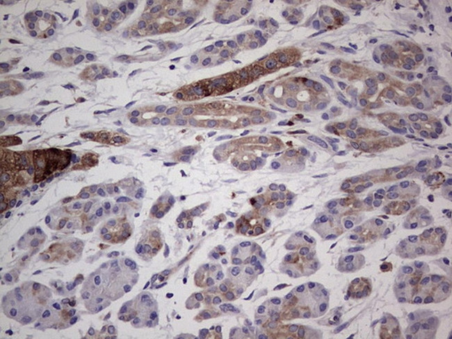 PKM2 Antibody in Immunohistochemistry (Paraffin) (IHC (P))