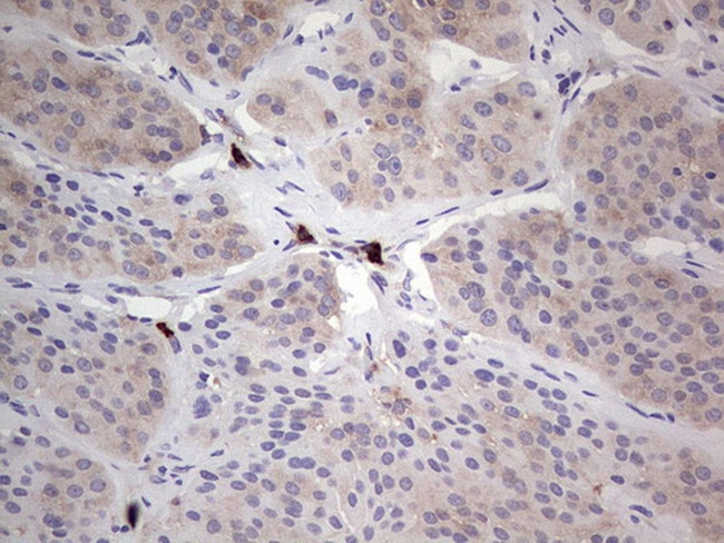 PKM2 Antibody in Immunohistochemistry (Paraffin) (IHC (P))