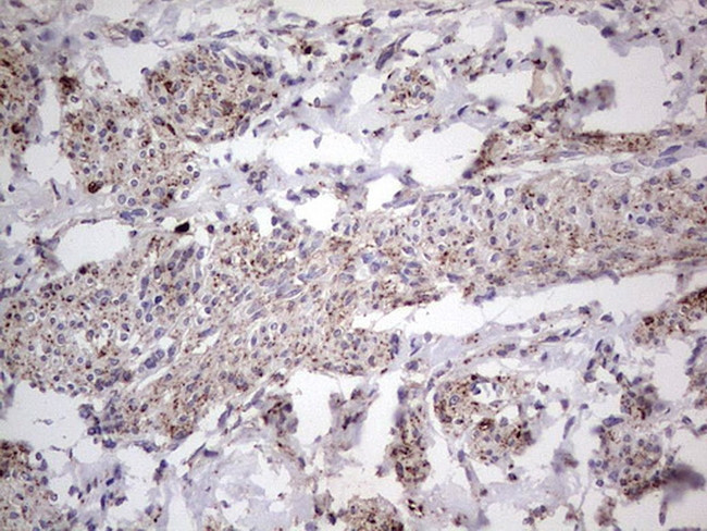 PKM2 Antibody in Immunohistochemistry (Paraffin) (IHC (P))