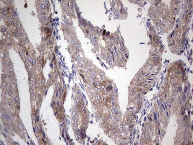 PKM2 Antibody in Immunohistochemistry (Paraffin) (IHC (P))