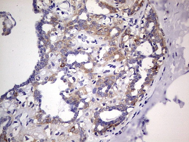 PKM2 Antibody in Immunohistochemistry (Paraffin) (IHC (P))