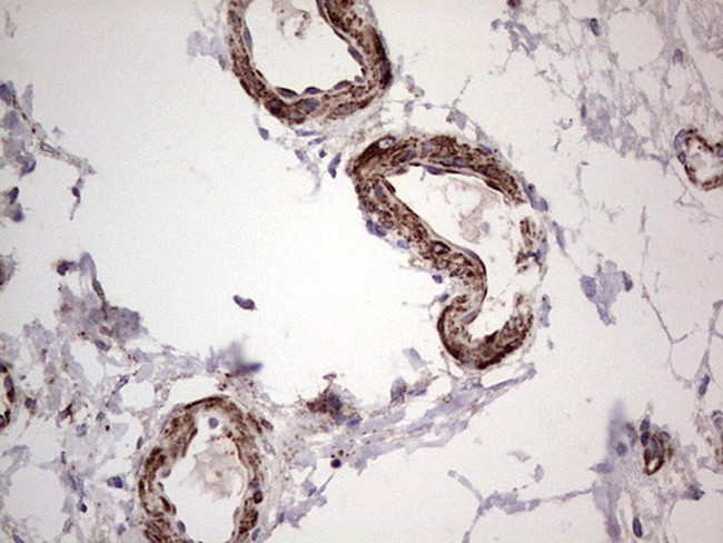 PKM2 Antibody in Immunohistochemistry (Paraffin) (IHC (P))