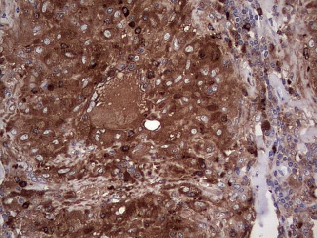 PKM2 Antibody in Immunohistochemistry (Paraffin) (IHC (P))