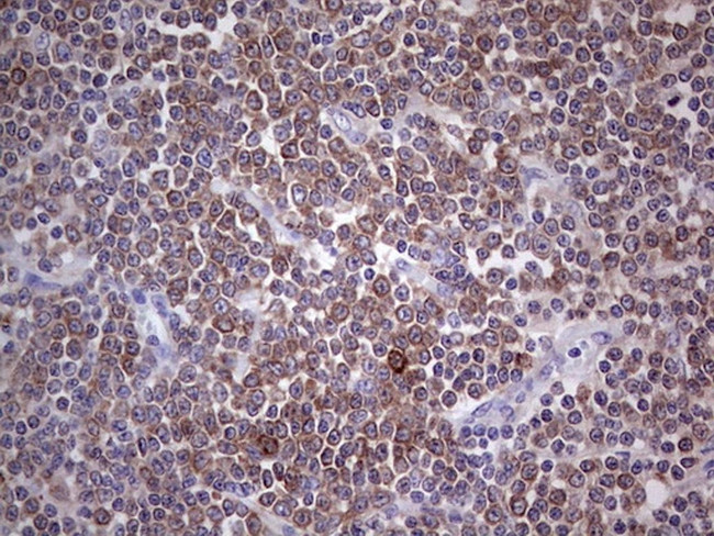 PKM2 Antibody in Immunohistochemistry (Paraffin) (IHC (P))