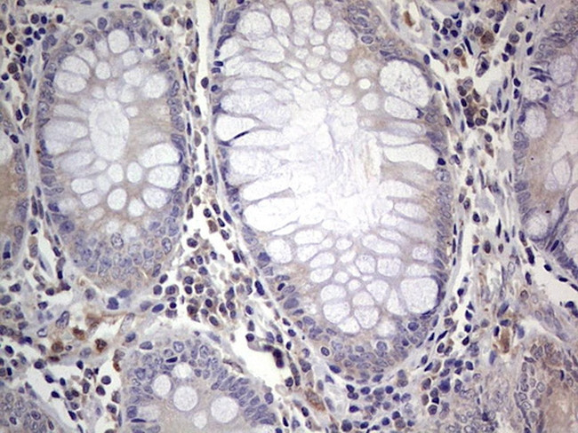 PKM2 Antibody in Immunohistochemistry (Paraffin) (IHC (P))