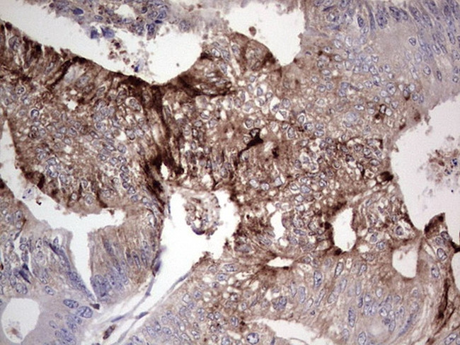 PKM2 Antibody in Immunohistochemistry (Paraffin) (IHC (P))