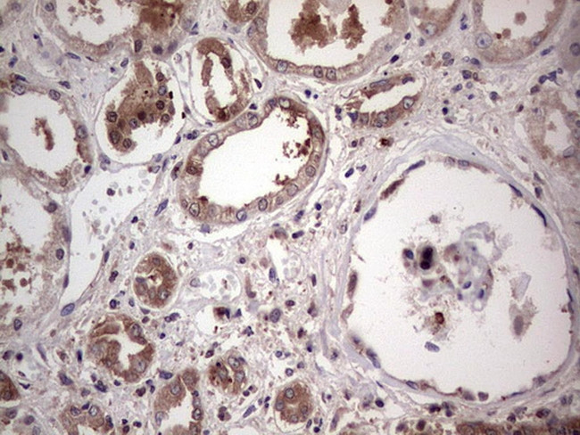 PKM2 Antibody in Immunohistochemistry (Paraffin) (IHC (P))