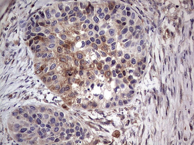 PKM2 Antibody in Immunohistochemistry (Paraffin) (IHC (P))