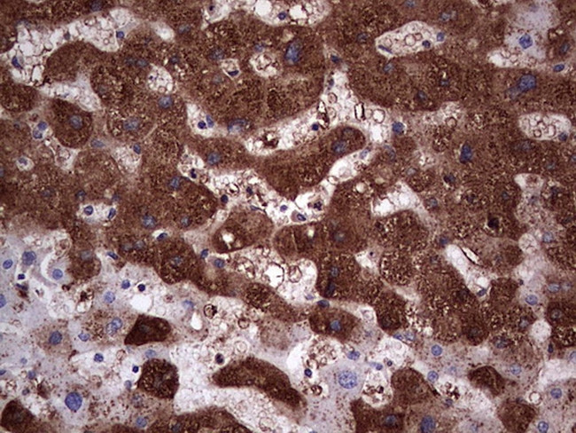 PKM2 Antibody in Immunohistochemistry (Paraffin) (IHC (P))