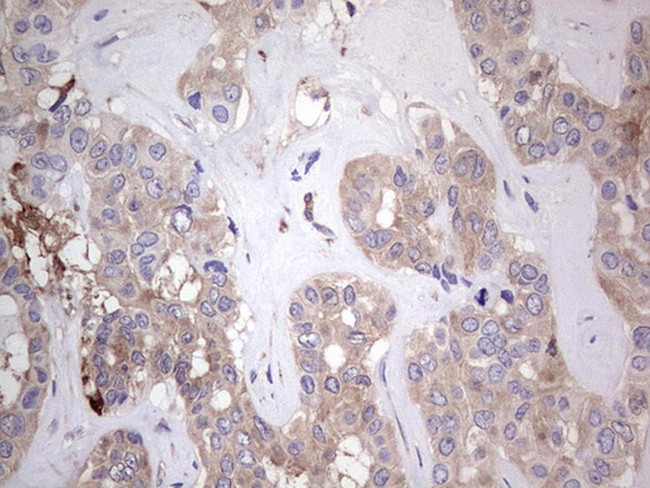 PKM2 Antibody in Immunohistochemistry (Paraffin) (IHC (P))