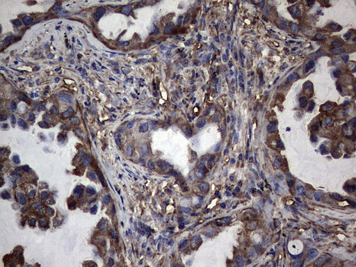 PKM2 Antibody in Immunohistochemistry (Paraffin) (IHC (P))