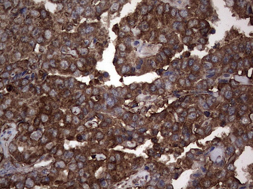 PKM2 Antibody in Immunohistochemistry (Paraffin) (IHC (P))