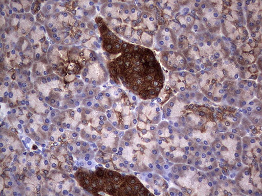 PKM2 Antibody in Immunohistochemistry (Paraffin) (IHC (P))