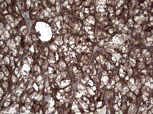 PKM2 Antibody in Immunohistochemistry (Paraffin) (IHC (P))