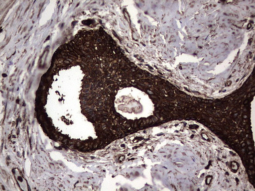 PKM2 Antibody in Immunohistochemistry (Paraffin) (IHC (P))