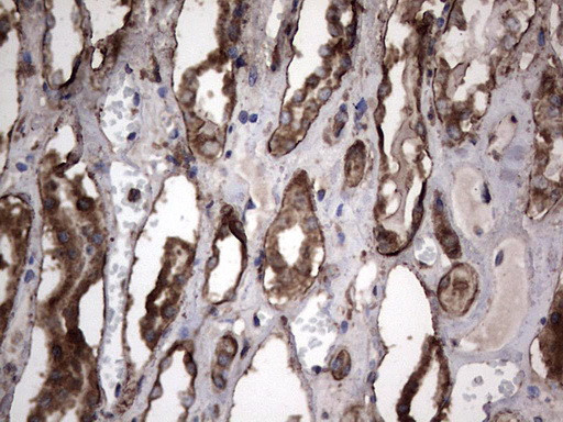 PKM2 Antibody in Immunohistochemistry (Paraffin) (IHC (P))