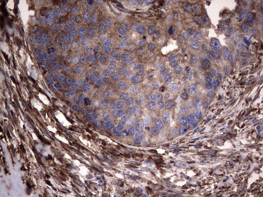 PKM2 Antibody in Immunohistochemistry (Paraffin) (IHC (P))