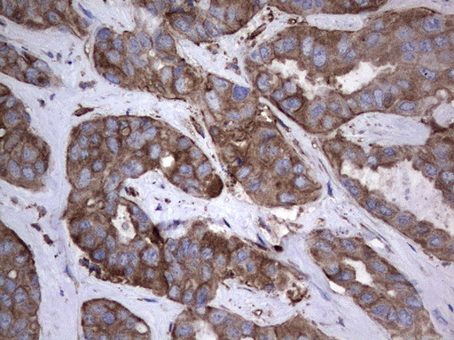 PKM2 Antibody in Immunohistochemistry (Paraffin) (IHC (P))