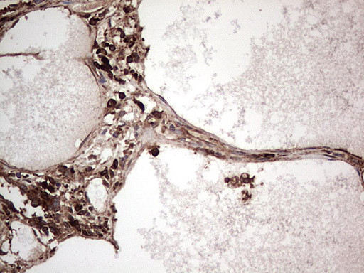 PKM2 Antibody in Immunohistochemistry (Paraffin) (IHC (P))