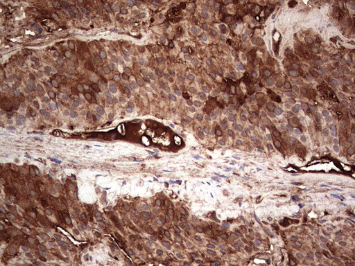 PKM2 Antibody in Immunohistochemistry (Paraffin) (IHC (P))