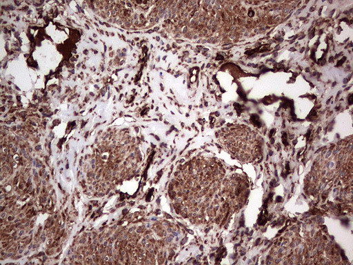 PKM2 Antibody in Immunohistochemistry (Paraffin) (IHC (P))