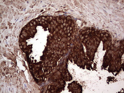 PKM2 Antibody in Immunohistochemistry (Paraffin) (IHC (P))