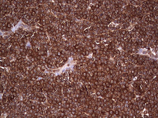 PKM2 Antibody in Immunohistochemistry (Paraffin) (IHC (P))