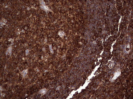 PKM2 Antibody in Immunohistochemistry (Paraffin) (IHC (P))