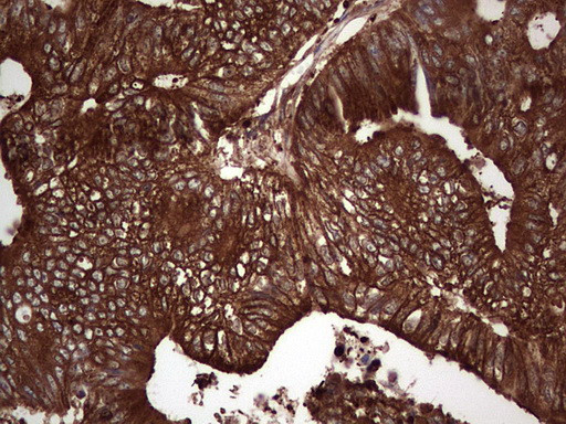 PKM2 Antibody in Immunohistochemistry (Paraffin) (IHC (P))