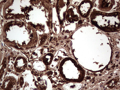 PKM2 Antibody in Immunohistochemistry (Paraffin) (IHC (P))