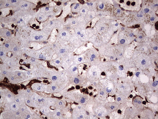 PKM2 Antibody in Immunohistochemistry (Paraffin) (IHC (P))