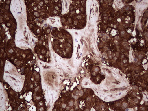 PKM2 Antibody in Immunohistochemistry (Paraffin) (IHC (P))