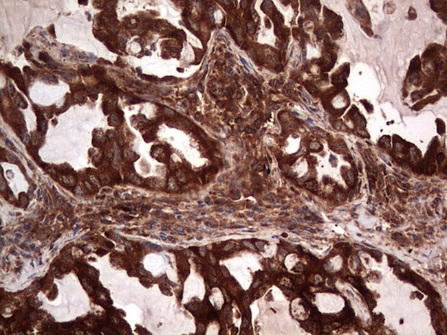 PKM2 Antibody in Immunohistochemistry (Paraffin) (IHC (P))