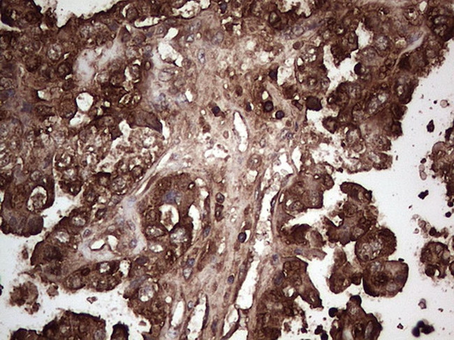 PKM2 Antibody in Immunohistochemistry (Paraffin) (IHC (P))