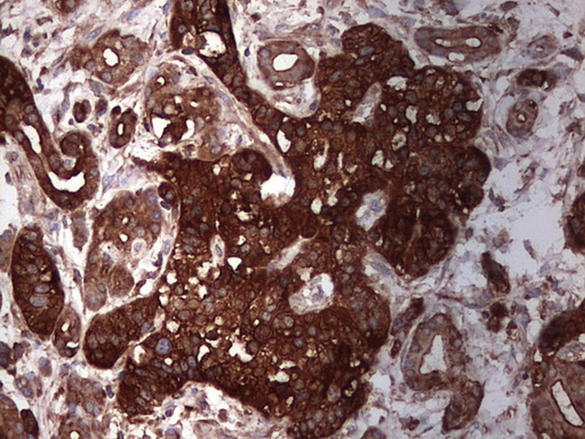 PKM2 Antibody in Immunohistochemistry (Paraffin) (IHC (P))