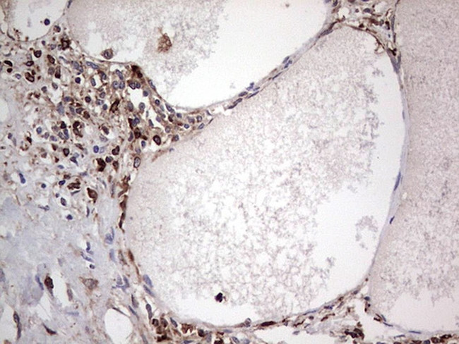 PKM2 Antibody in Immunohistochemistry (Paraffin) (IHC (P))