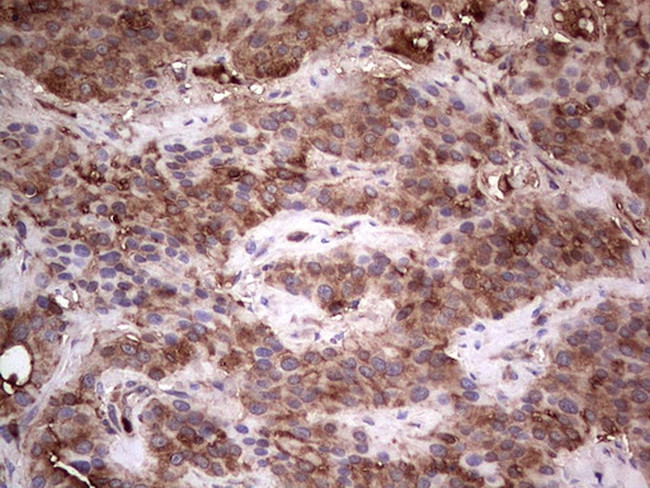 PKM2 Antibody in Immunohistochemistry (Paraffin) (IHC (P))