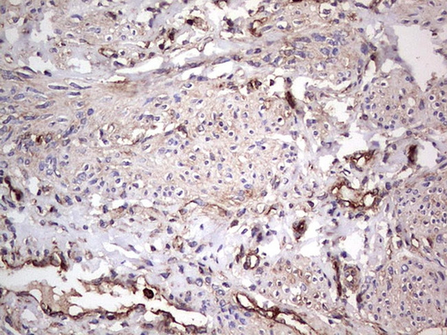 PKM2 Antibody in Immunohistochemistry (Paraffin) (IHC (P))