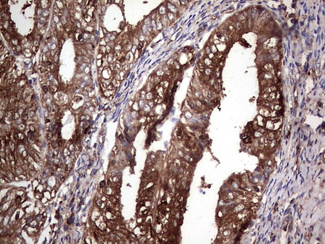 PKM2 Antibody in Immunohistochemistry (Paraffin) (IHC (P))