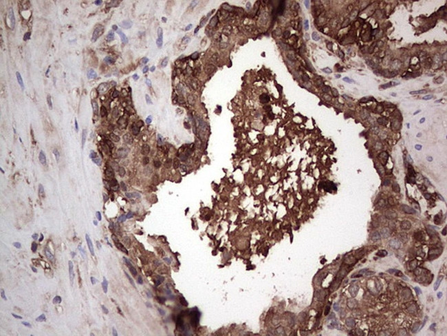 PKM2 Antibody in Immunohistochemistry (Paraffin) (IHC (P))